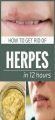 Getridofherpes